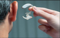 Hearing Aid Selection by Aura Hearing And Speech Care Centre