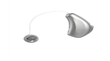 Starkey Design Receiver-In-Canal Hearing Aids by Clear Tone Hearing Solutions