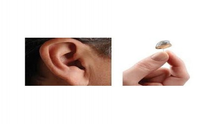 Completely In Canal Hearing Aid by Aai Speech & Hearing India Private Limited