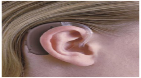 Siemens Intuis 2 Sp Hearing Aid by Digital Hearing Aid Centre