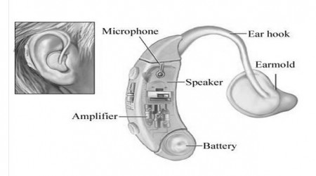 Behind The Ear Aids by Hearing Aids Centre
